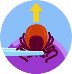 Illustration of removing a tick from skin